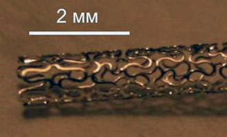 Coronary stent